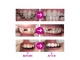 1112-3.webp