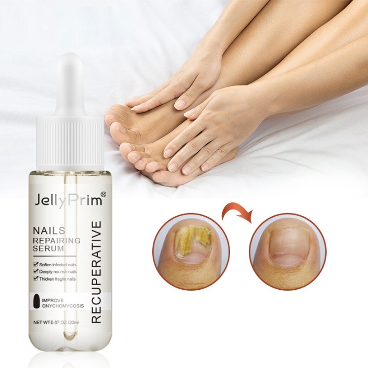 Nail-Mycosis-Strong-Nail-Repair-Liquid-Manufacturer-code-fwefgfd565.jpg