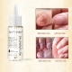 Nail-Mycosis-Strong-Nail-Repair-Liquid-Brand-BHEPRW.jpg