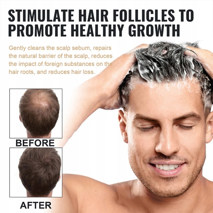 Shampoo-For-Hair-Growth-Supports-Hair-Growth-Brand-no-brand.jpg