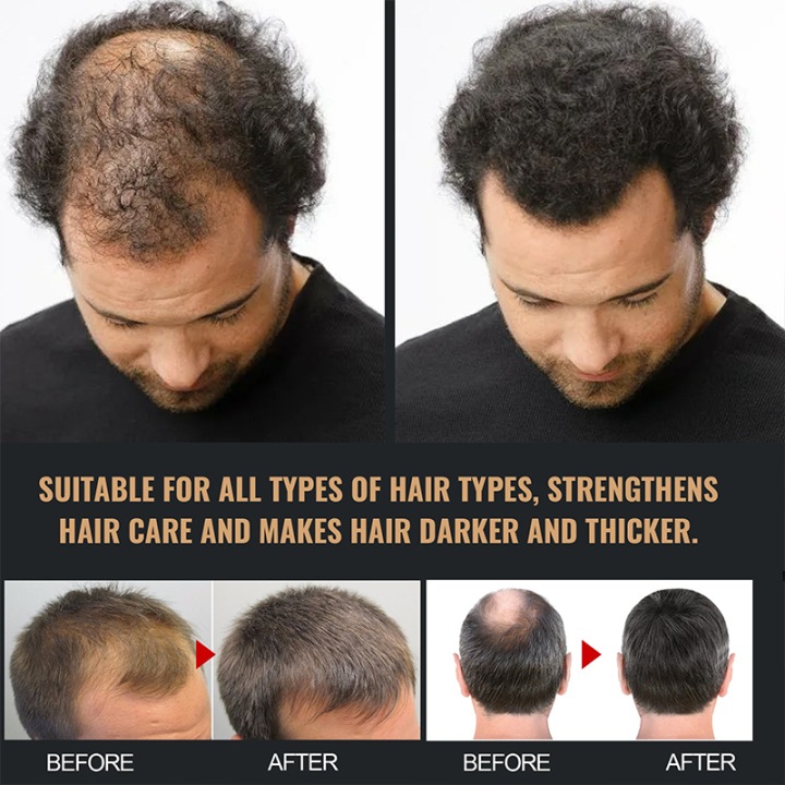 Shampoo-For-Hair-Growth-Supports-Hair-Growth-Effect-hair-growth-stimulation.jpg